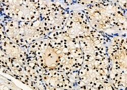Invitrogen PRKAR1B Polyclonal Antibody 100 &mu;L | Buy Online | Invitrogen&trade; | Fisher Scientific