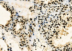 Invitrogen PRKAR1B Polyclonal Antibody 100 &mu;L | Buy Online | Invitrogen&trade; | Fisher Scientific