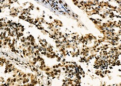 Invitrogen PRKAR1B Polyclonal Antibody 100 &mu;L | Buy Online | Invitrogen&trade; | Fisher Scientific