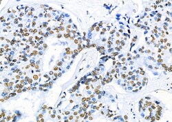 Invitrogen PRKAR1B Polyclonal Antibody 100 &mu;L | Buy Online | Invitrogen&trade; | Fisher Scientific