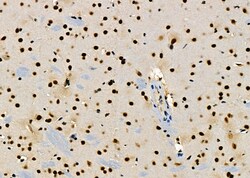 Invitrogen PRKAR1B Polyclonal Antibody 100 &mu;L | Buy Online | Invitrogen&trade; | Fisher Scientific