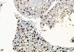 Invitrogen PRKAR1B Polyclonal Antibody 100 &mu;L | Buy Online | Invitrogen&trade; | Fisher Scientific