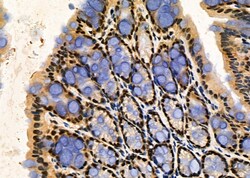 Invitrogen PRKAR1B Polyclonal Antibody 100 &mu;L | Buy Online | Invitrogen&trade; | Fisher Scientific