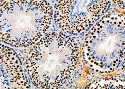 Invitrogen PRKAR1B Polyclonal Antibody 100 &mu;L | Buy Online | Invitrogen&trade; | Fisher Scientific