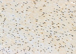 Invitrogen PRKAR1B Polyclonal Antibody 100 &mu;L | Buy Online | Invitrogen&trade; | Fisher Scientific