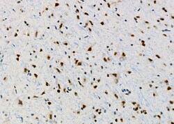 Invitrogen PRKAR1B Polyclonal Antibody 100 &mu;L | Buy Online | Invitrogen&trade; | Fisher Scientific