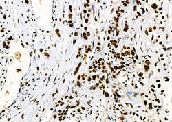 Invitrogen PRKAR1B Polyclonal Antibody 100 &mu;L | Buy Online | Invitrogen&trade; | Fisher Scientific