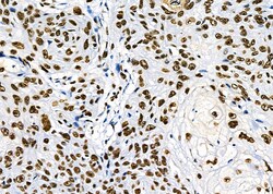 Invitrogen PRKAR1B Polyclonal Antibody 100 &mu;L | Buy Online | Invitrogen&trade; | Fisher Scientific
