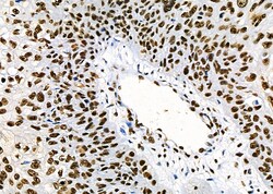 Invitrogen PRKAR1B Polyclonal Antibody 100 &mu;L | Buy Online | Invitrogen&trade; | Fisher Scientific