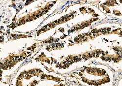 Invitrogen PRKAR1B Polyclonal Antibody 100 &mu;L | Buy Online | Invitrogen&trade; | Fisher Scientific