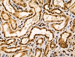 Invitrogen CIITA Polyclonal Antibody 100 &mu;L; Unconjugated:Antibodies,