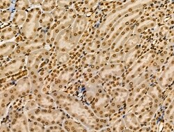 Invitrogen CIITA Polyclonal Antibody 100 &mu;L; Unconjugated:Antibodies,