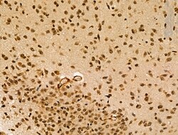 Invitrogen CIITA Polyclonal Antibody 100 &mu;L; Unconjugated:Antibodies,