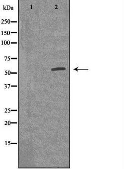 Invitrogen ACVR1B Polyclonal Antibody 100 &mu;L; Unconjugated:Antibodies,