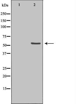 Invitrogen ETV6 Polyclonal Antibody 100 &mu;L; Unconjugated:Antibodies,