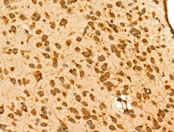 Invitrogen GRK6 Polyclonal Antibody 100 &mu;L; Unconjugated:Antibodies,