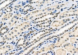 Invitrogen HOXA1 Polyclonal Antibody 100 &mu;L; Unconjugated:Antibodies,