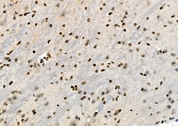 Invitrogen HOXA1 Polyclonal Antibody 100 &mu;L; Unconjugated:Antibodies,