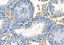 Invitrogen HOXA1 Polyclonal Antibody 100 &mu;L; Unconjugated:Antibodies,