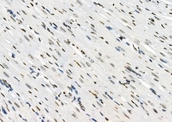 Invitrogen HOXA1 Polyclonal Antibody 100 &mu;L; Unconjugated:Antibodies,