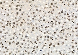 Invitrogen HOXA1 Polyclonal Antibody 100 &mu;L; Unconjugated:Antibodies,