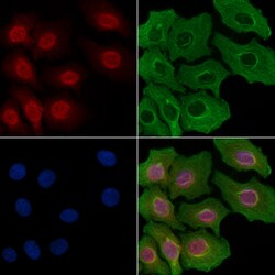 Invitrogen ETV1 Polyclonal Antibody 100 &mu;L; Unconjugated:Antibodies,