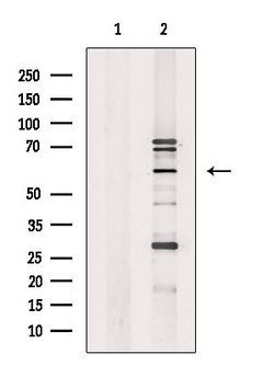 Invitrogen ETV1 Polyclonal Antibody 100 &mu;L; Unconjugated:Antibodies,