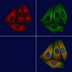 Invitrogen BAP31 Polyclonal Antibody 100 &mu;L; Unconjugated:Antibodies,