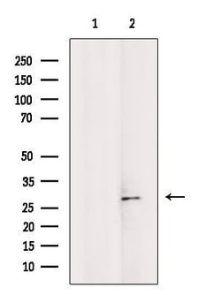 Invitrogen BAP31 Polyclonal Antibody 100 &mu;L; Unconjugated:Antibodies,