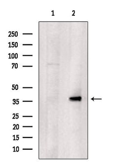 ZNF134 Polyclonal Antibody:Antibodies, Polyclonal