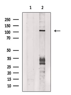 Invitrogen DGKQ Polyclonal Antibody 100 &mu;L; Unconjugated:Antibodies,