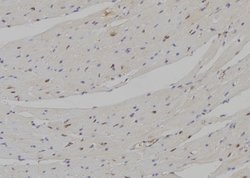Invitrogen DLX5 Polyclonal Antibody 100 &mu;L; Unconjugated:Antibodies,