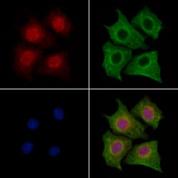 Invitrogen LMO4 Polyclonal Antibody 100 &mu;L | Buy Online | Invitrogen&trade; | Fisher Scientific