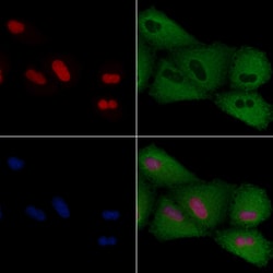 PITX1 Polyclonal Antibody:Antibodies, Polyclonal
