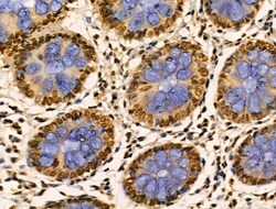 PITX1 Polyclonal Antibody:Antibodies, Polyclonal