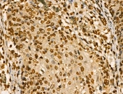 PITX1 Polyclonal Antibody:Antibodies, Polyclonal