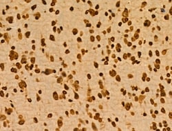PITX1 Polyclonal Antibody:Antibodies, Polyclonal