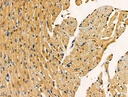 PITX1 Polyclonal Antibody:Antibodies, Polyclonal