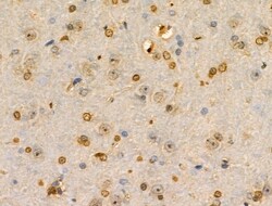 PITX1 Polyclonal Antibody:Antibodies, Polyclonal