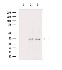 PITX1 Polyclonal Antibody:Antibodies, Polyclonal