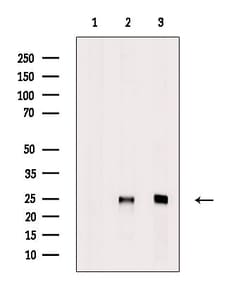 Invitrogen SRSF3 Polyclonal Antibody 100 &mu;L | Buy Online | Invitrogen&trade; | Fisher Scientific