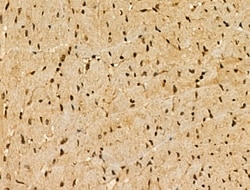 CDKL1 Polyclonal Antibody:Antibodies, Polyclonal
