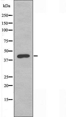 CDKL1 Polyclonal Antibody:Antibodies, Polyclonal