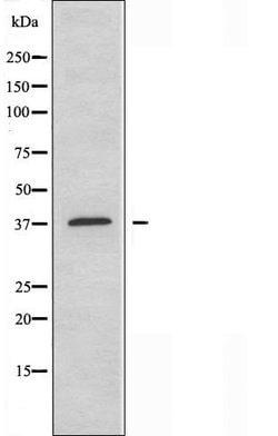 Invitrogen MEF2B Polyclonal Antibody 100 &mu;L; Unconjugated:Antibodies,