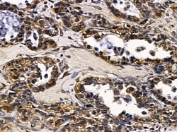 Invitrogen SRY Polyclonal Antibody 100 &mu;L; Unconjugated:Antibodies,