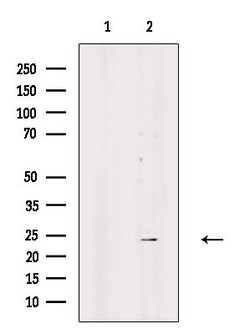 Invitrogen SRY Polyclonal Antibody 100 &mu;L; Unconjugated:Antibodies,