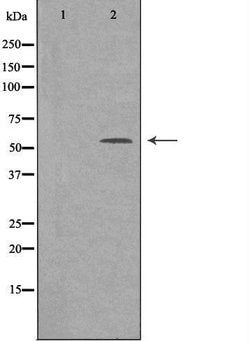 Invitrogen SRSF4 Polyclonal Antibody 100 &mu;L | Buy Online | Invitrogen&trade; | Fisher Scientific