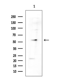 Invitrogen SRSF4 Polyclonal Antibody 100 &mu;L | Buy Online | Invitrogen&trade; | Fisher Scientific