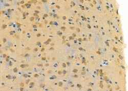 Invitrogen ELAVL2 Polyclonal Antibody 100 &mu;L; Unconjugated:Antibodies,