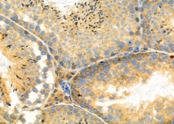 Invitrogen ELAVL2 Polyclonal Antibody 100 &mu;L; Unconjugated:Antibodies,